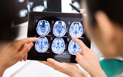 Brain Scans Could Distinguish Bipolar Disorder From Depression